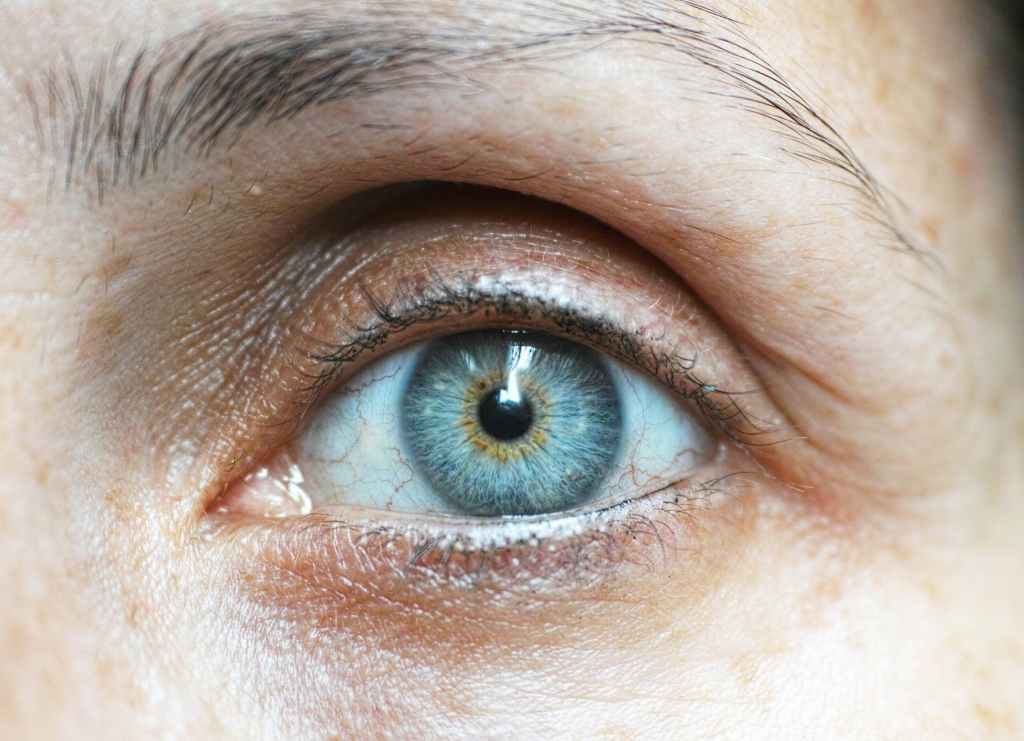Dry eye syndrome in fibromyalgia&nbsp;patients