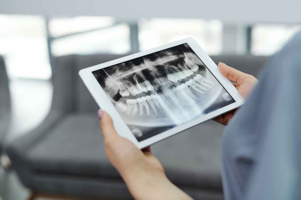 Jaw pain in&nbsp;Fibromyalgia